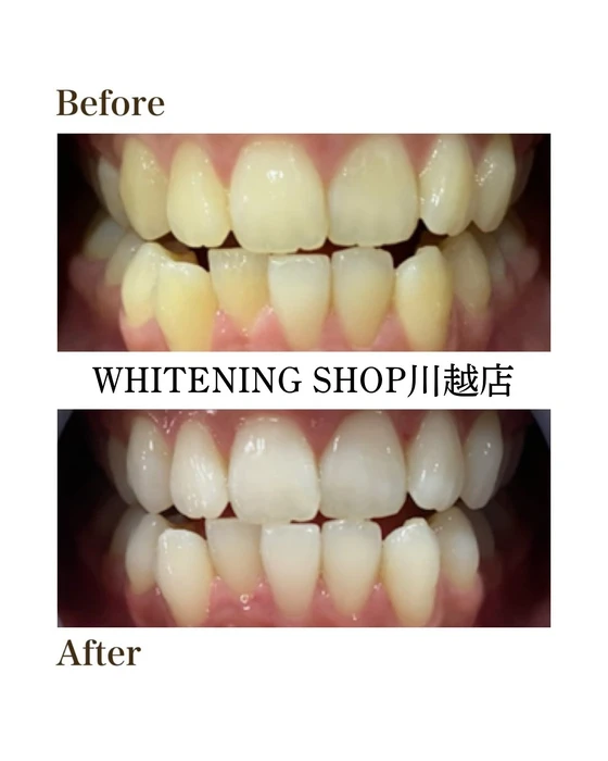 画像1094