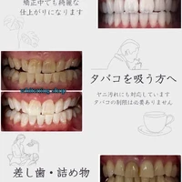 画像1102