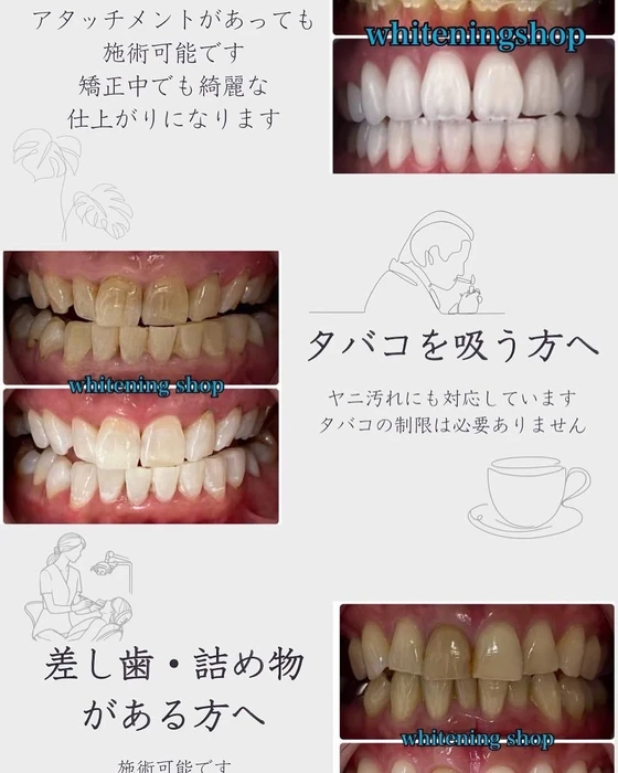 画像1102