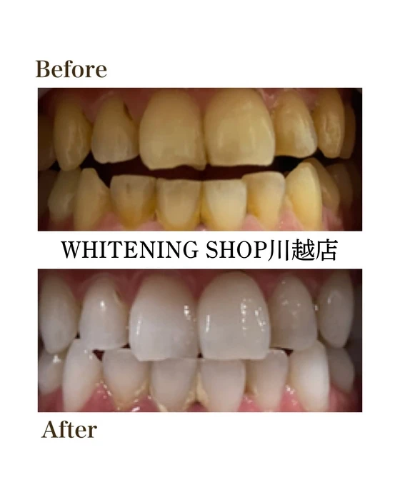 画像1138