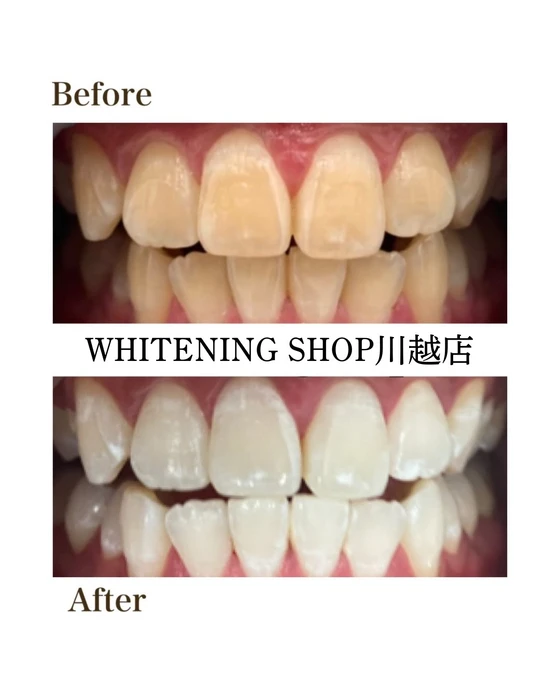 画像1237