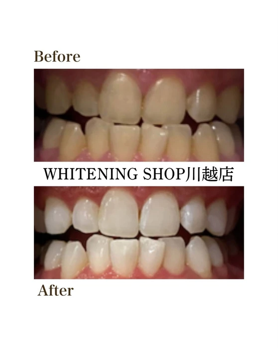 画像1268