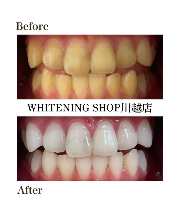 画像1290