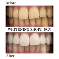 画像1396