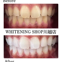 画像1416