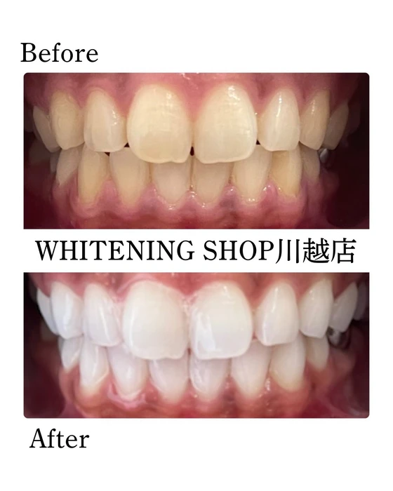 画像1416