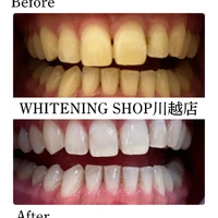 画像1423