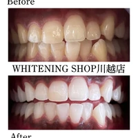画像1501