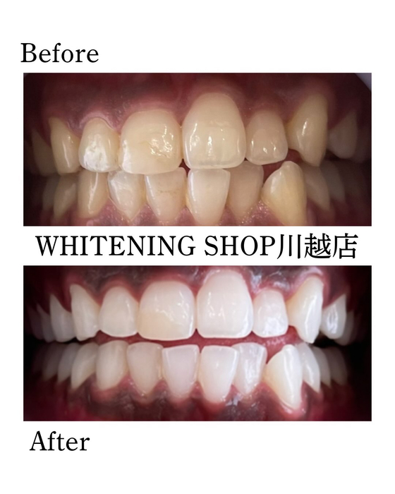 画像1501