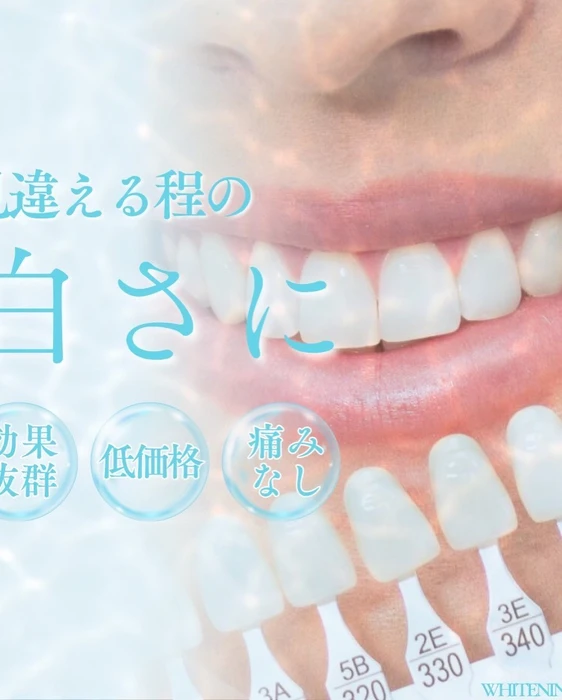 画像1502