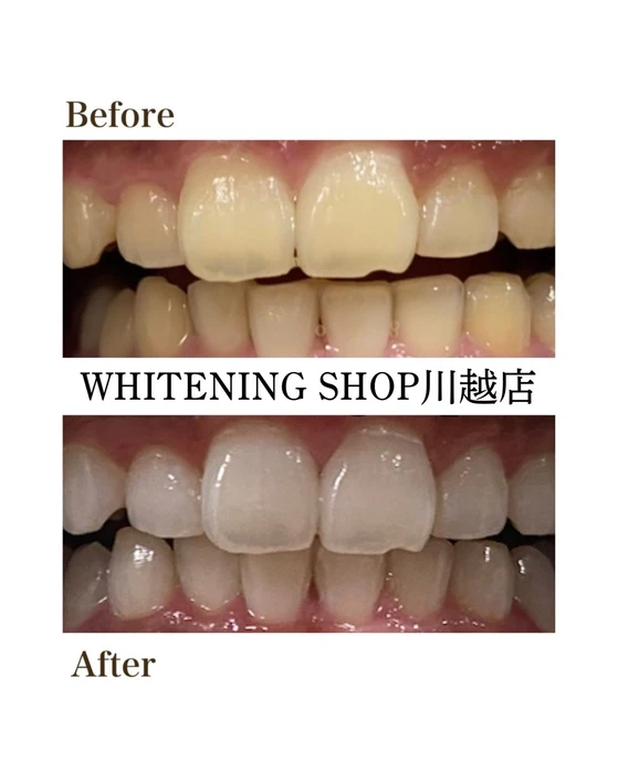 画像1509