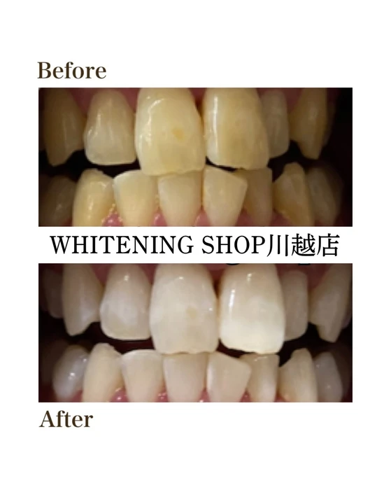 画像1558