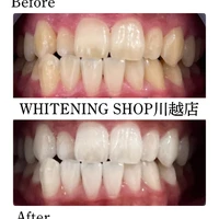 画像1577