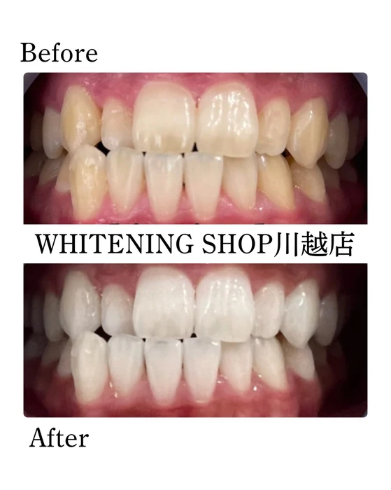 画像1577