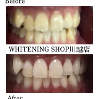 画像1617