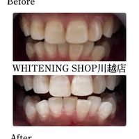 画像1682