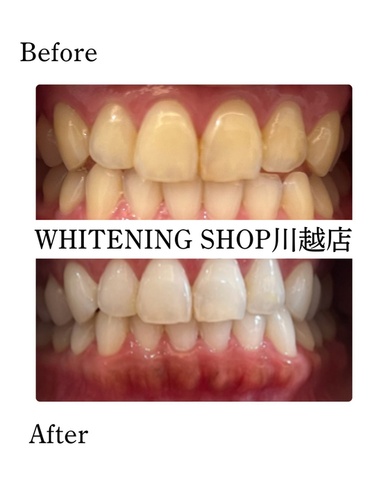 画像1708