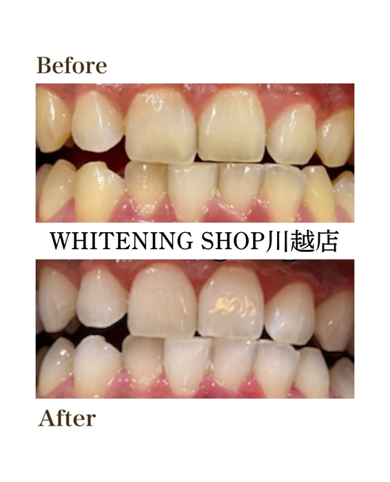 画像1726