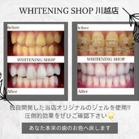 画像460