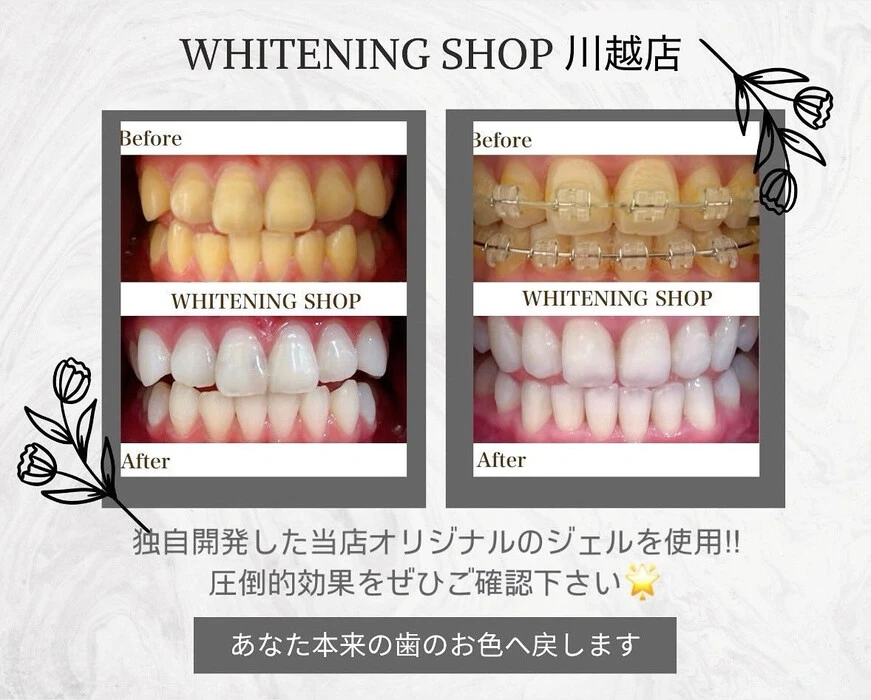 画像460