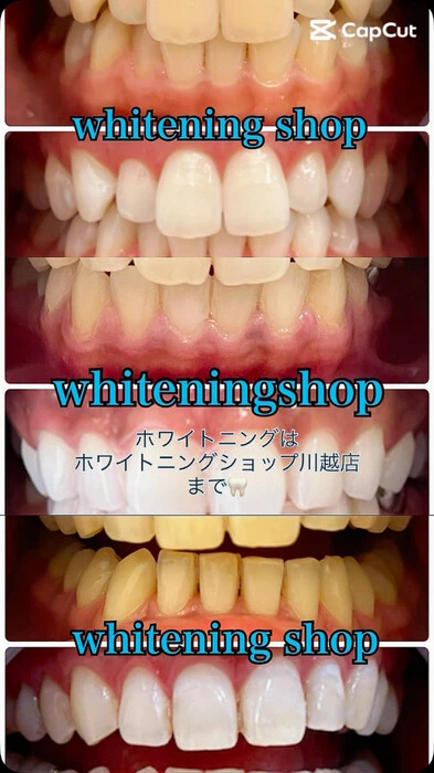 画像654