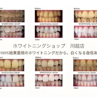画像860