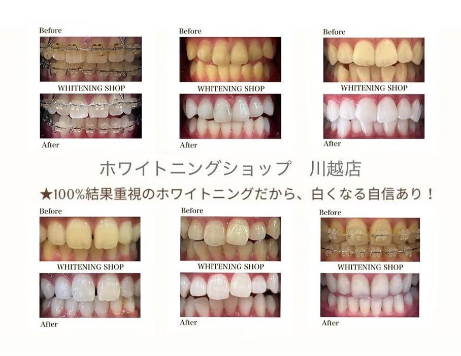 画像860