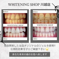 画像871